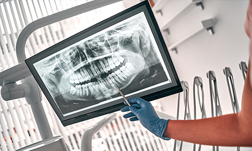 Medical image reconstruction and video analytics, for surgical robots and surgeons.