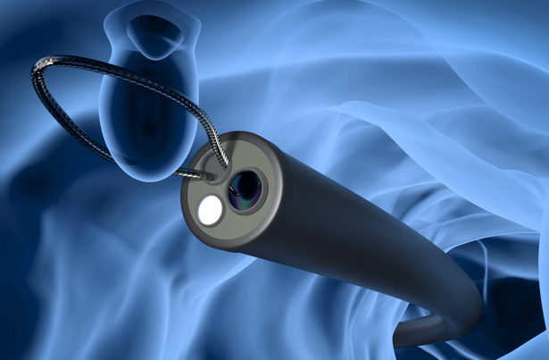 Case 3-Endoscopy Diagnosis and Treatment with AI Implementation