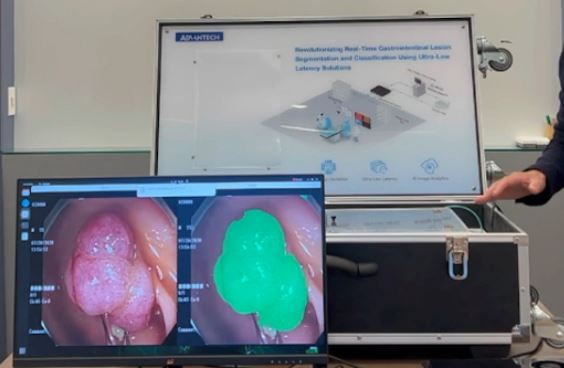 Advantech Endoscopy Surgical Systems with AI-Driven Real-Time Detection