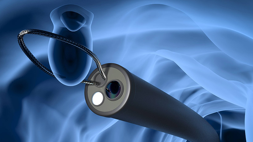 Endoscopy Diagnosis and Treatment with AI Implementation